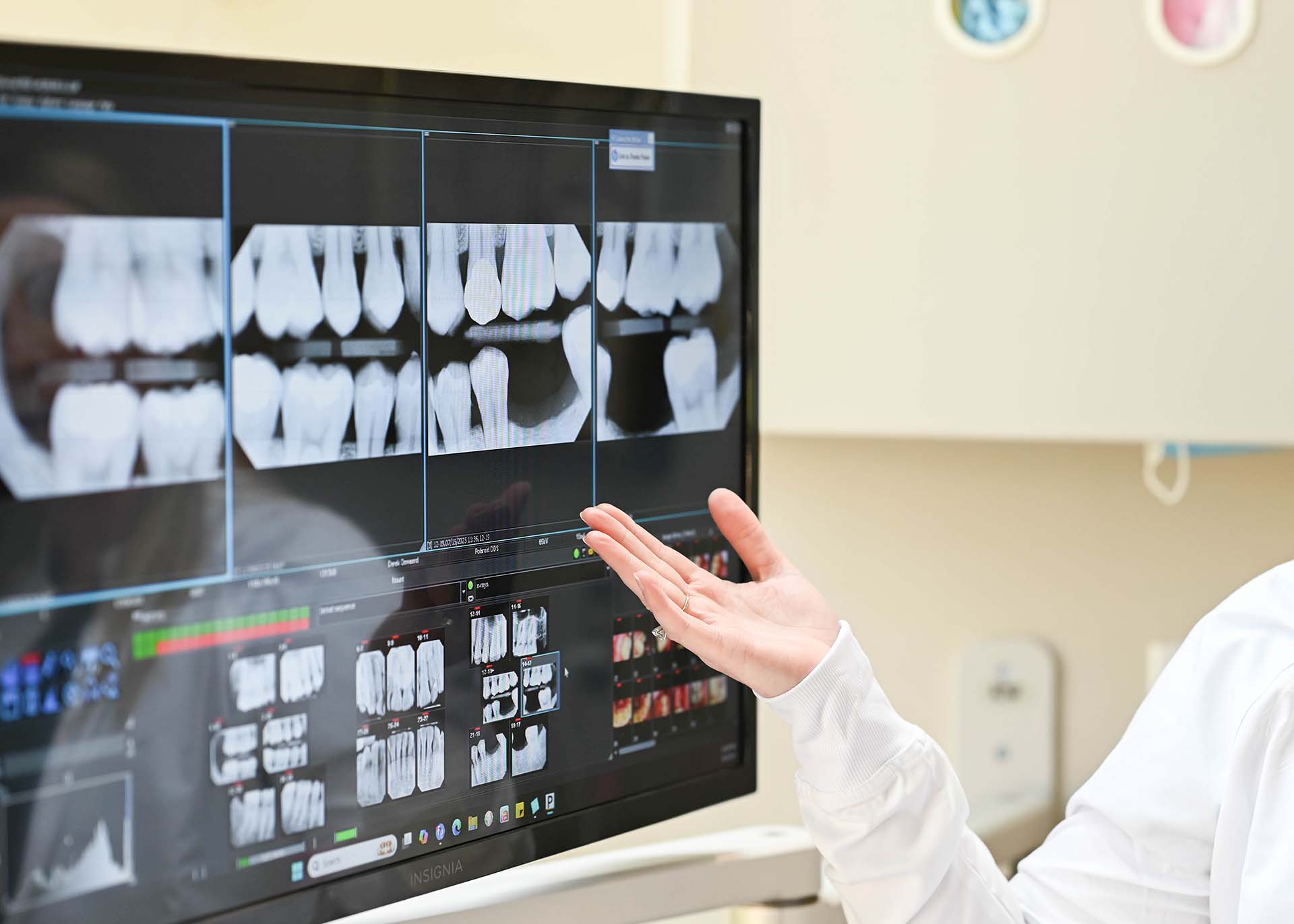 Dental Bridge Dentists Near You